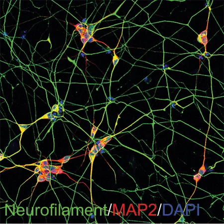 hiPSC-derived motor neurons